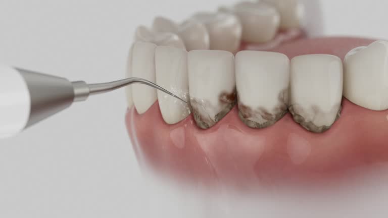 Reliable Dental contractor in Mountlake Terrace, WA by Dentist Open Now